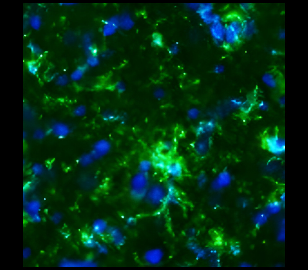 IR257-912 anti-CD11b / ITGAM antibody IHC-Fr image IR257-912 anti-CD11b / ITGAM antibody IHC-Fr image