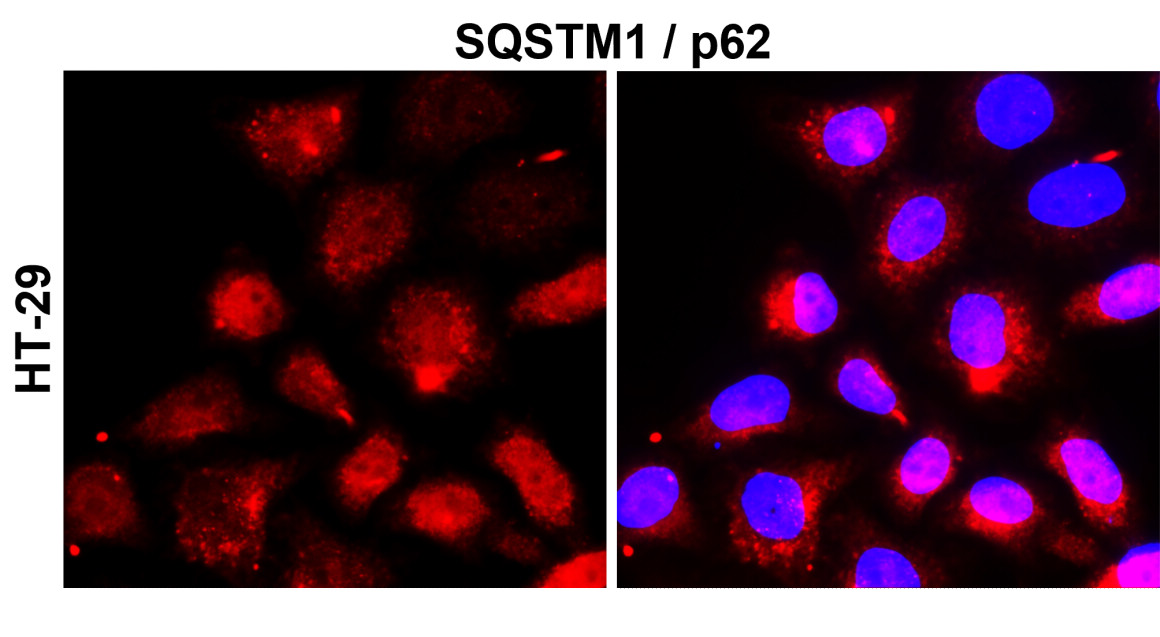 IR91-384 anti-SQSTM1 / p62 antibody_HT-29 ICC/ IF image