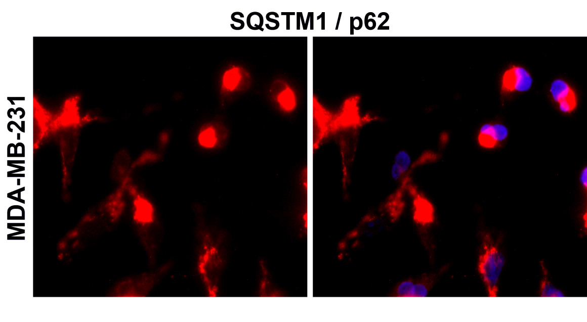 IR91-384 anti-SQSTM1 / p62 antibody_MDA-MB-231 ICC/ IF image
