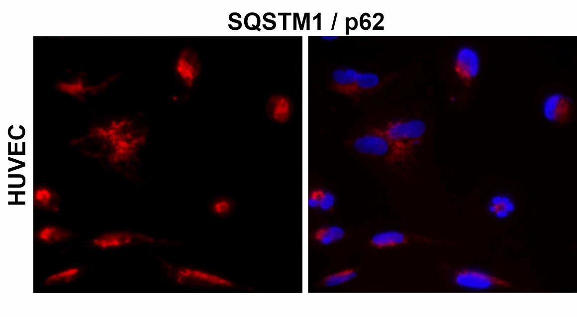 IR91-384 anti-SQSTM1 / p62 antibody_HUVEC ICC/ IF image