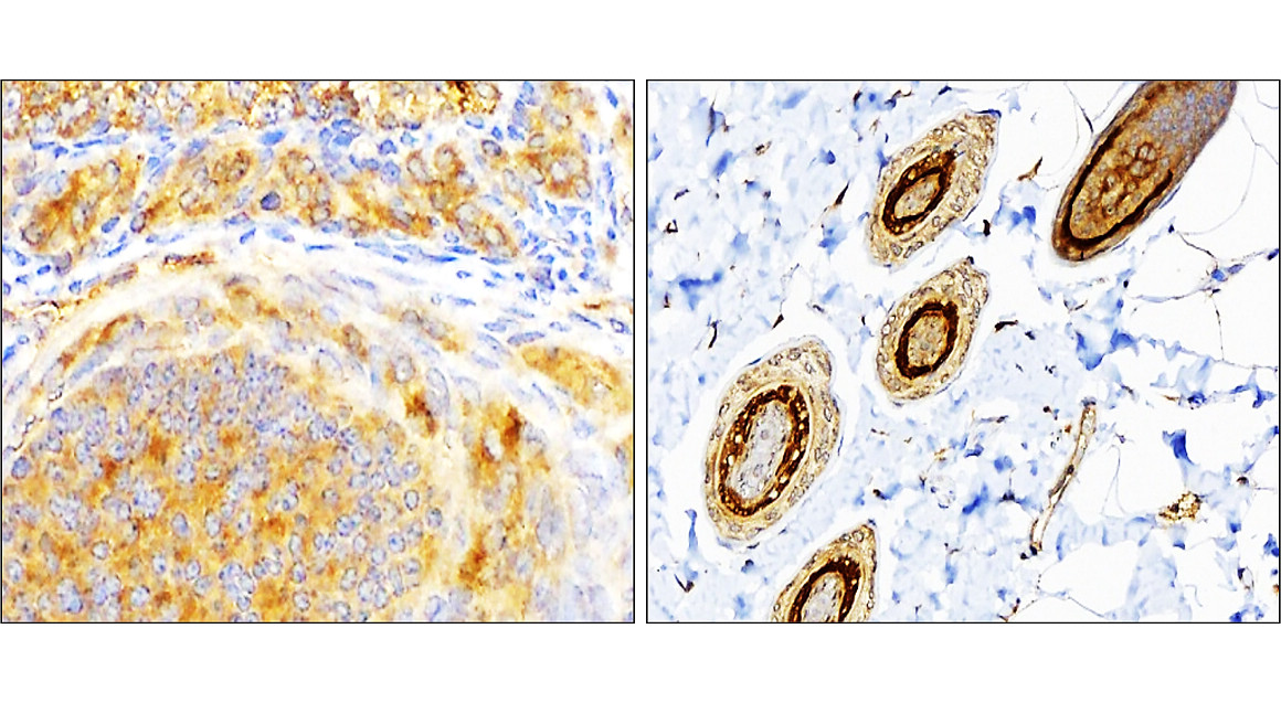 IR91-384 anti-SQSTM1 / p62 antibody  IHC image