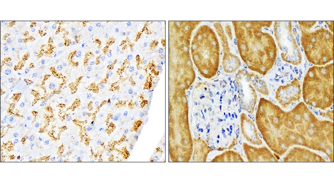IR91-384 anti-SQSTM1 / p62 antibody IHC image