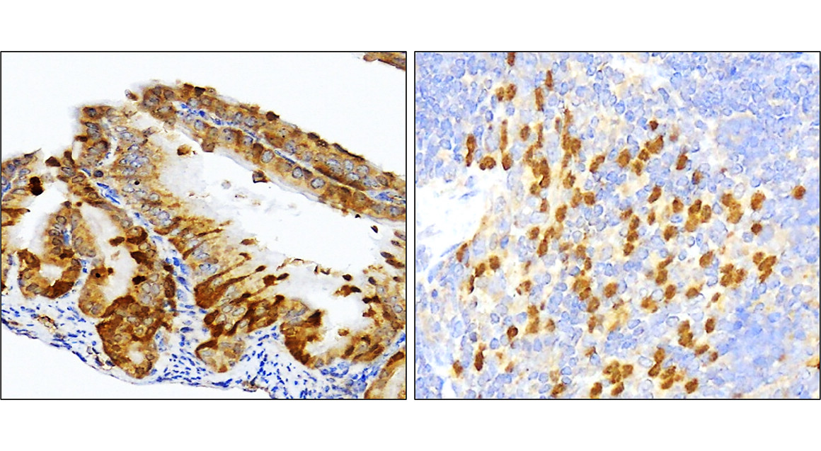 IR91-384 anti-SQSTM1 / p62 antibody IHC image
