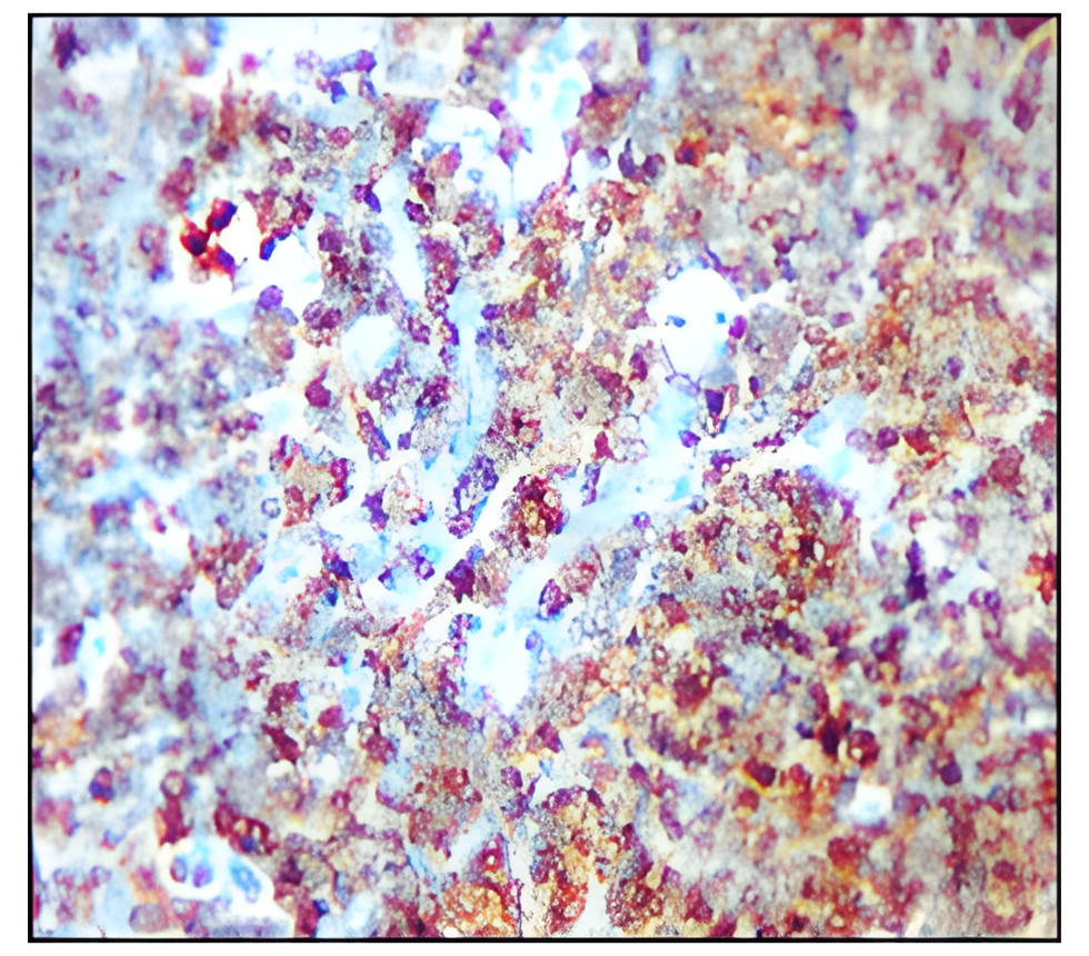IR253-901 anti-CD19 antibody IHC image