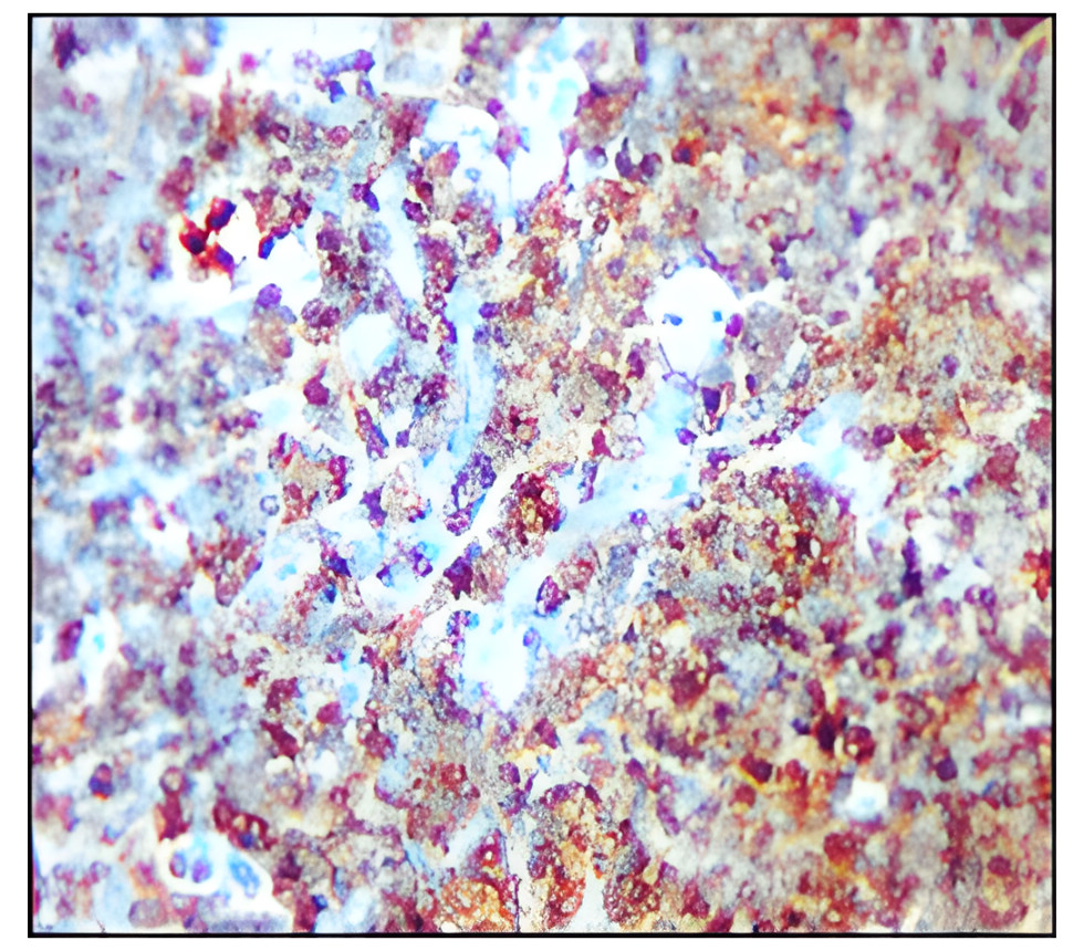 IR253-901 anti-CD19 antibody IHC image IR253-901 anti-CD19 antibody IHC image