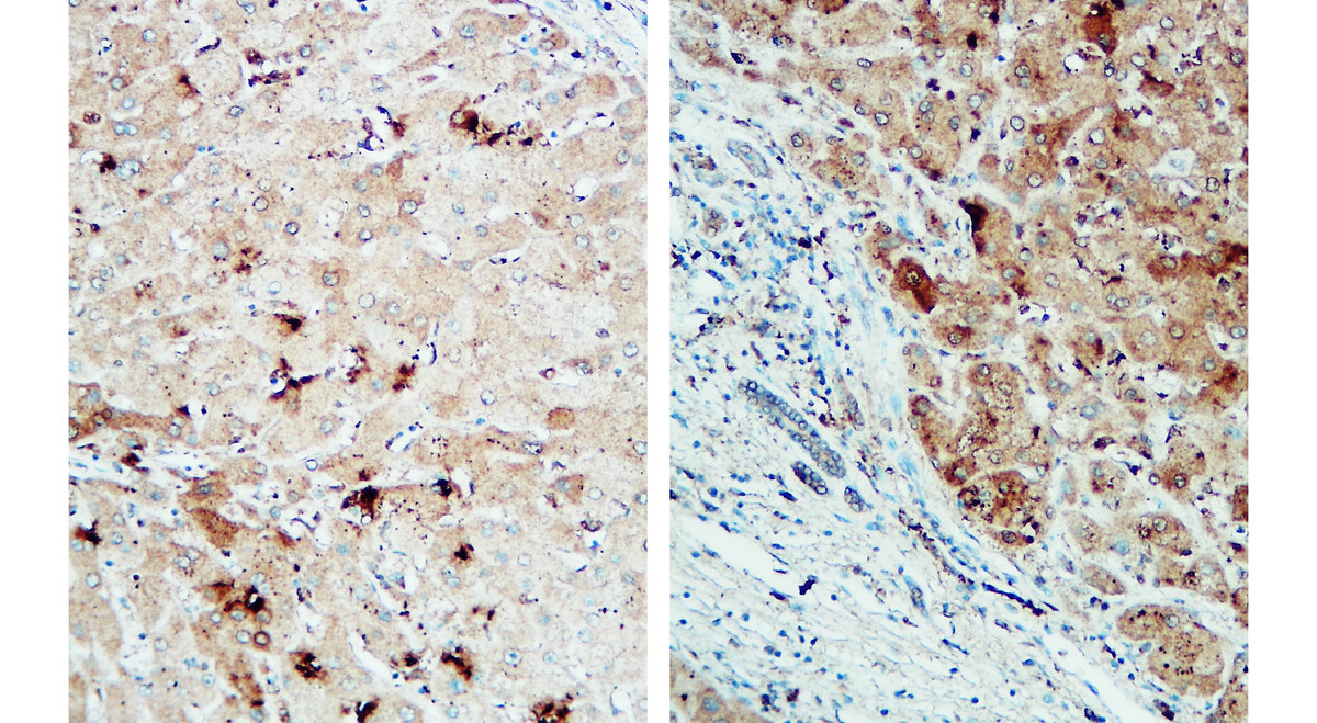 IR92-388 anti-NLRP3 antibody IHC image IR92-388 anti-NLRP3 antibody IHC image