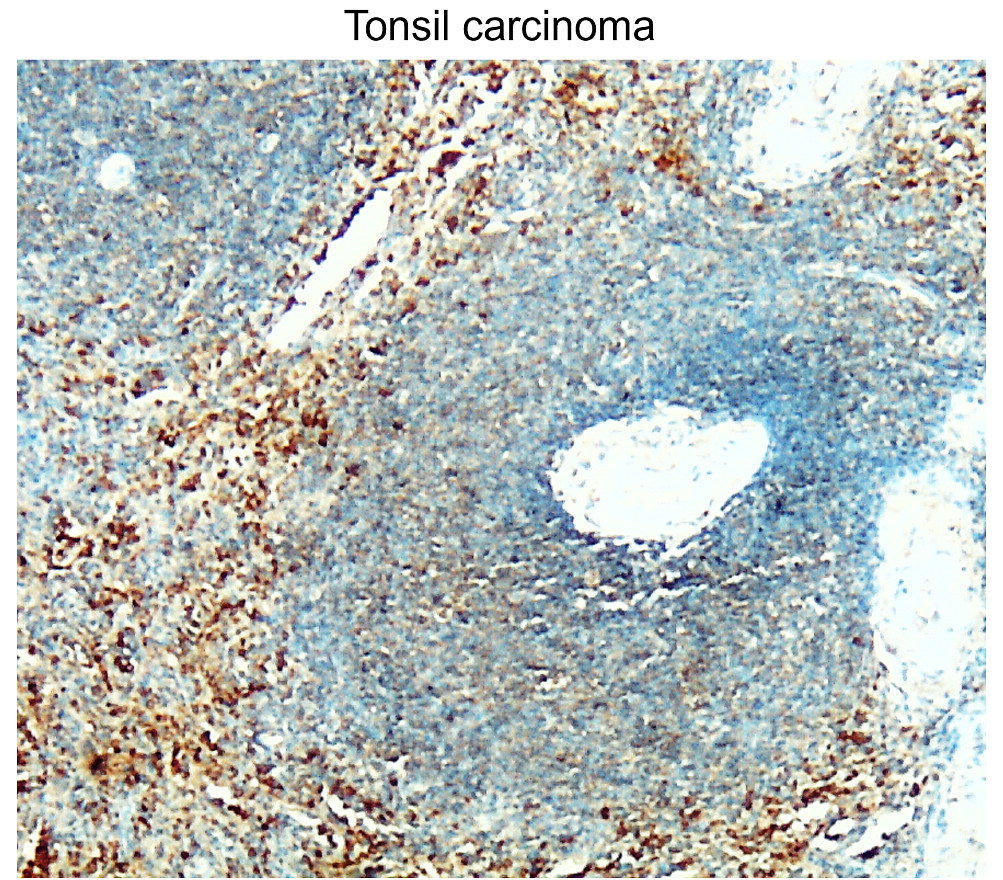 Customer feedback Image IR93-389 anti-BAX antibody IHC image