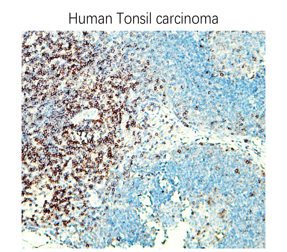 IR252-2 anti-CD3 antibody IHC image IR252-2 anti-CD3 antibody IHC image