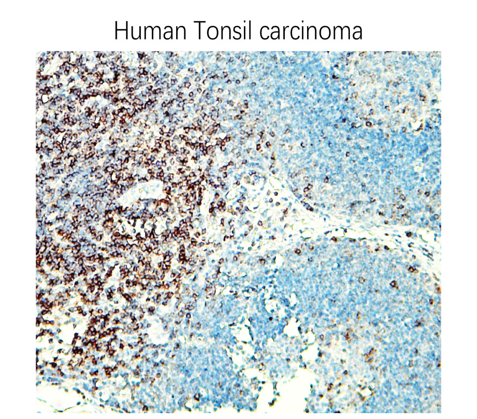 IR252-2 anti-CD3 antibody IHC image