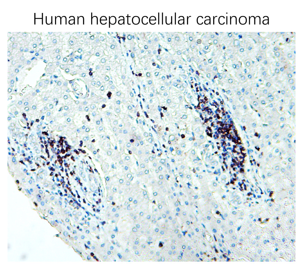 IR252-2 anti-CD3 antibody IHC image IR252-2 anti-CD3 antibody IHC image