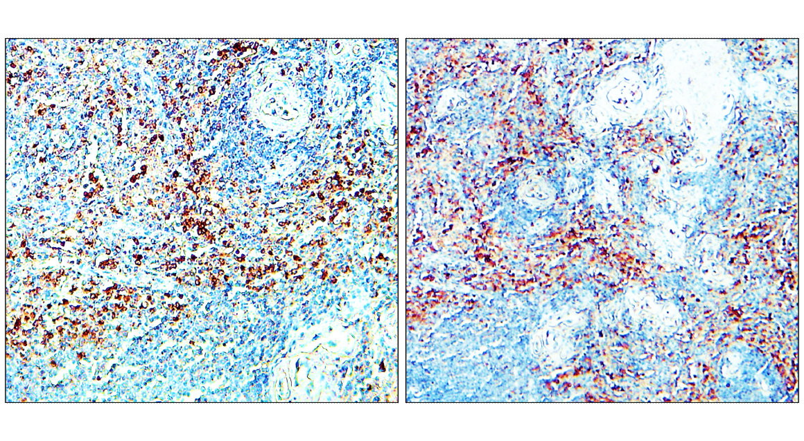 IR240-864 anti-CD206 / MRC1 / Mannose Receptor antibody  IHC image