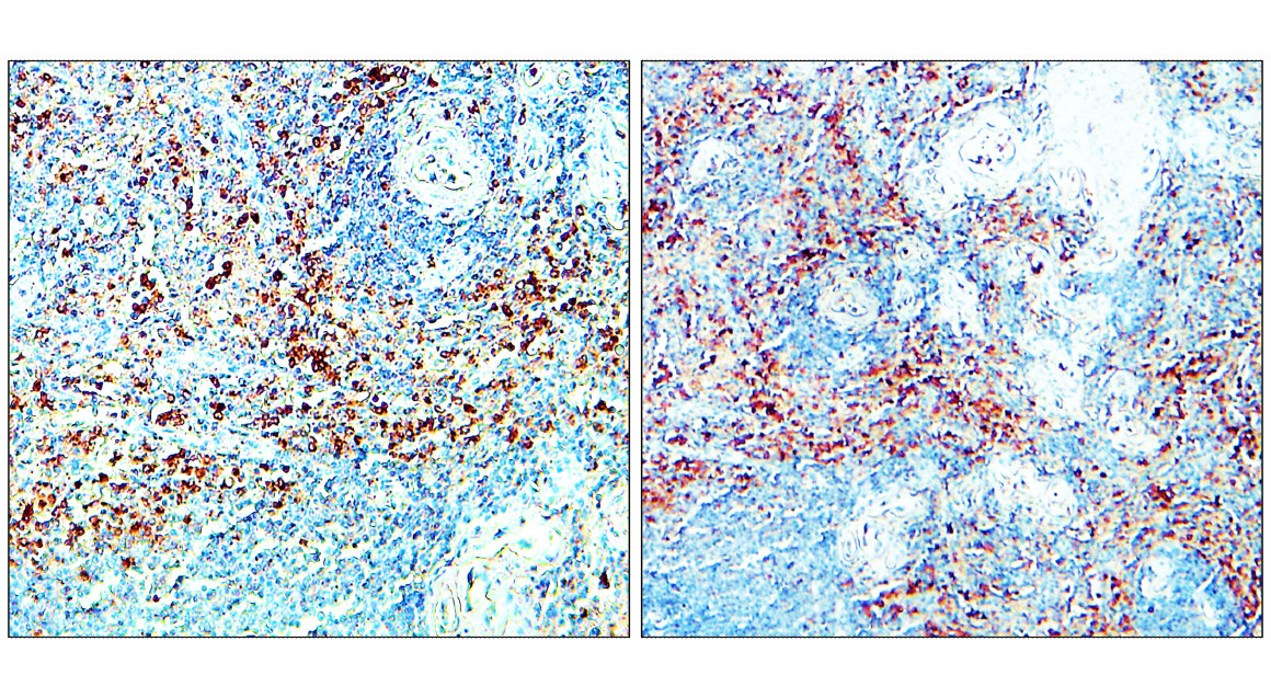 IR240-864 anti-CD206 / MRC1 / Mannose Receptor antibody IHC image IR240-864 anti-CD206 / MRC1 / Mannose Receptor antibody IHC image