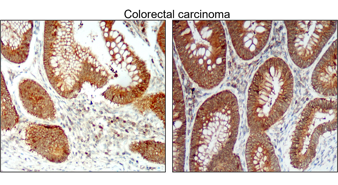 IR94-392 抗 BCL2 抗體 IHC 圖像