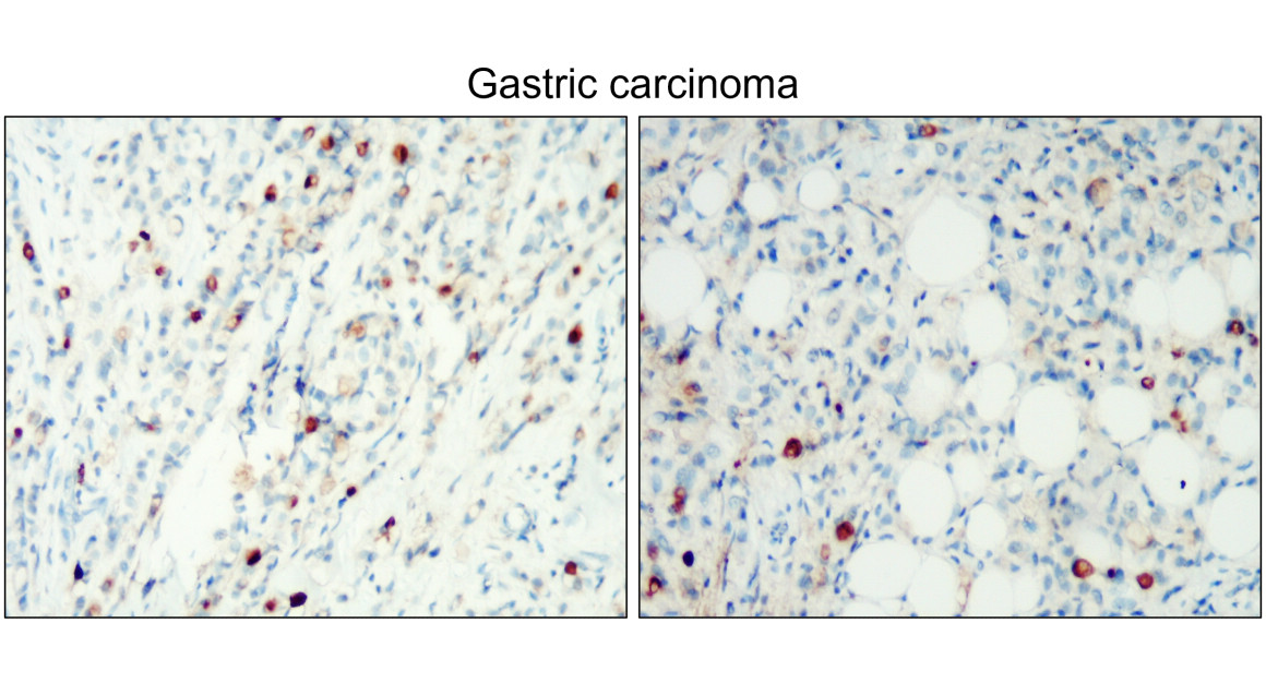 IR239-896 anti- CD138 / Syndecan-1 antibody IHC image IR239-896 anti- CD138 / Syndecan-1 antibody IHC image