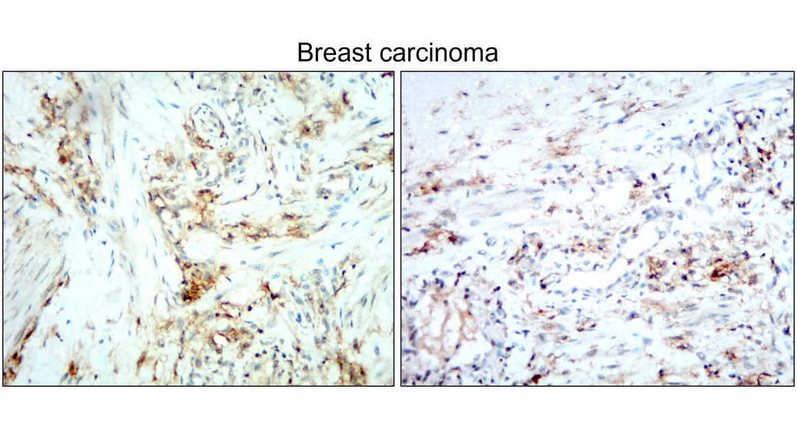 IR239-896 anti- CD138 / Syndecan-1 antibody IHC image IR239-896 anti- CD138 / Syndecan-1 antibody IHC image