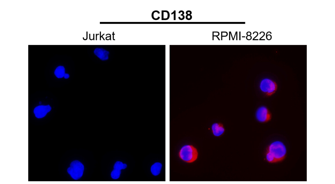 IR239-896 anti- CD138 / Syndecan-1 antibody ICC/IF image IR239-896 anti- CD138 / Syndecan-1 antibody ICC/IF image