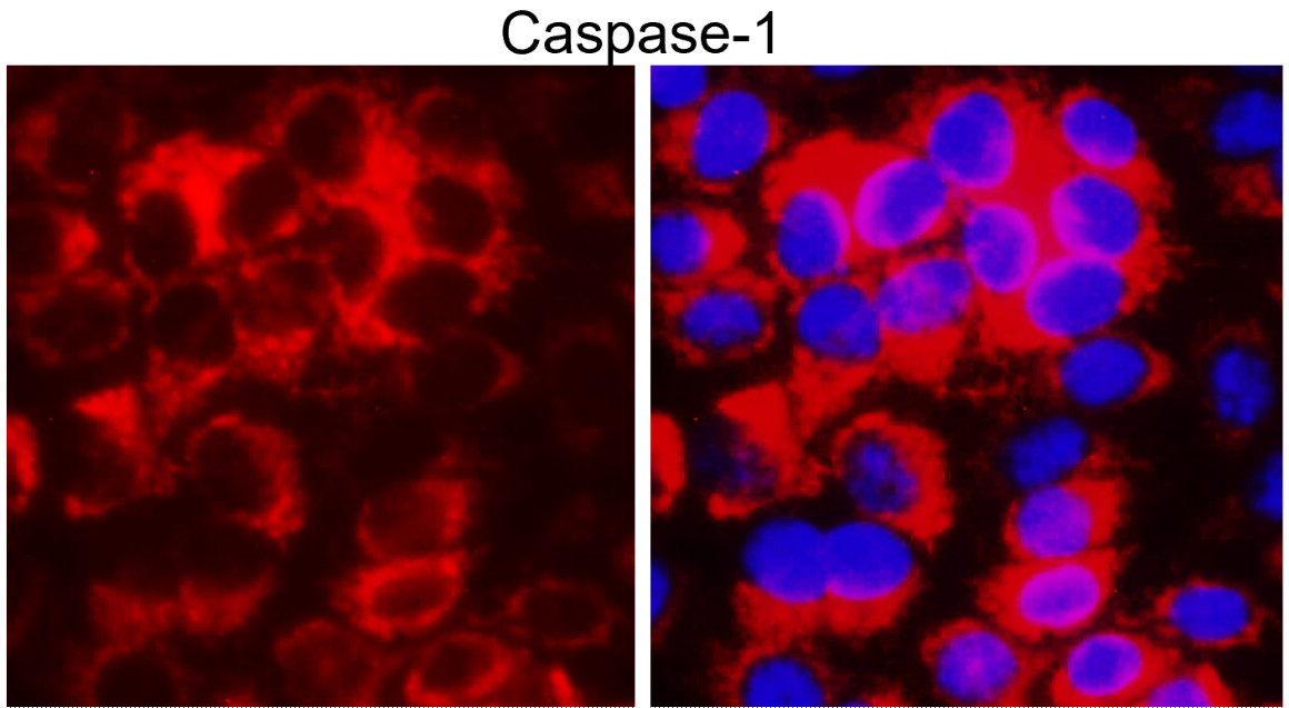 IR95-397 anti-Caspase-1 Cleaved Asp297 antibody ICC/IF image IR95-397 anti-Caspase-1 Cleaved Asp297 antibody ICC/IF image