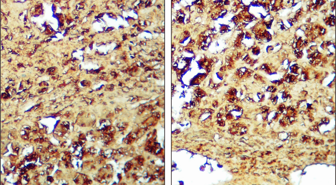 IR96-401 anti-Caspase 3 p17/19 antibody IHC  image