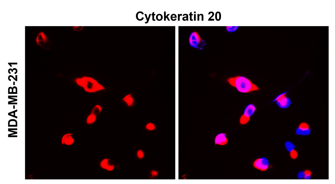 IR238-892 anti-Cytokeratin 20 antibody ICC/IF image IR238-892 anti-Cytokeratin 20 antibody ICC/IF image