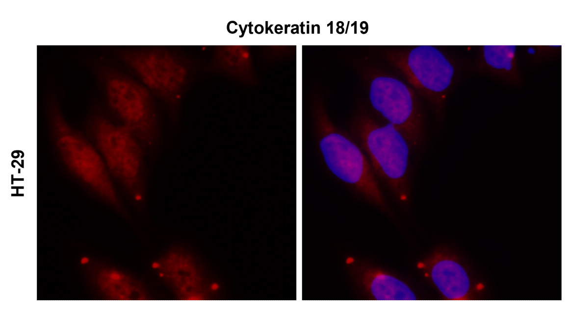 IR236-890 anti-Cytokeratin 18/19 antibody ICC/IF image IR236-890 anti-Cytokeratin 18/19 antibody ICC/IF image