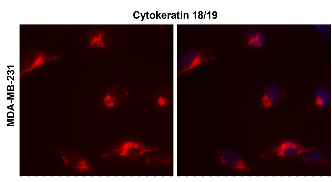 IR236-890 anti-Cytokeratin 18/19 antibody ICC/IF image IR236-890 anti-Cytokeratin 18/19 antibody ICC/IF image