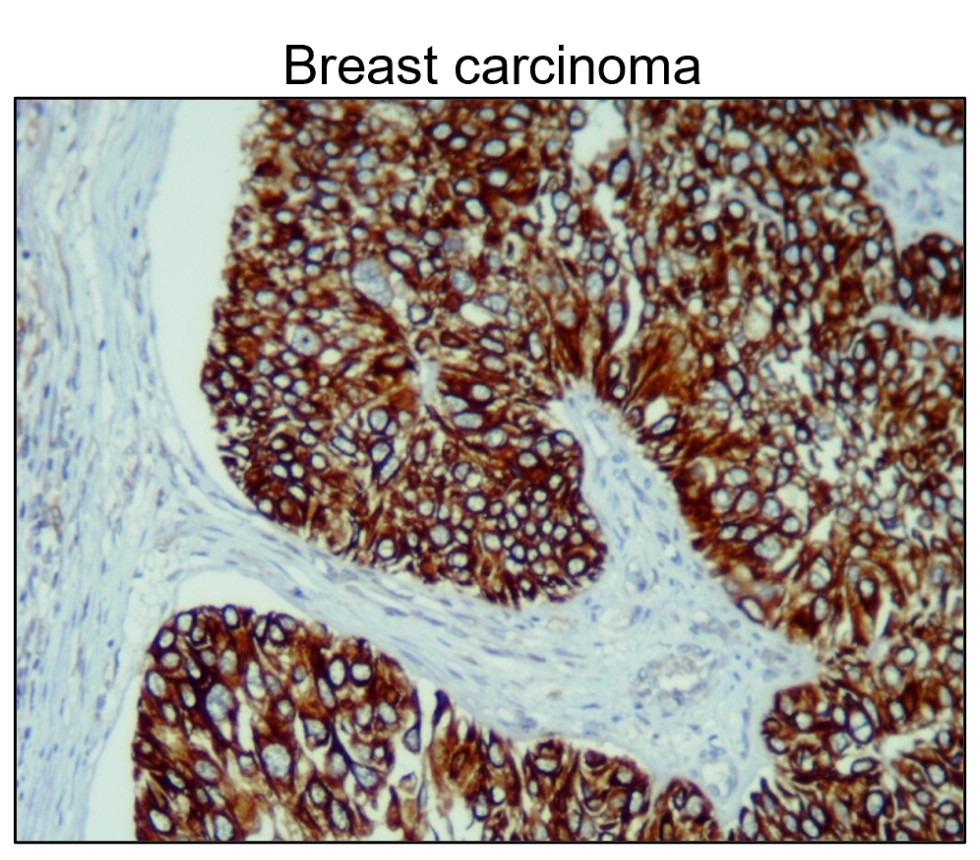 IR235-880 anti-Cytokeratin 14/17 antibody IHC image IR235-880 anti-Cytokeratin 14/17 antibody IHC image