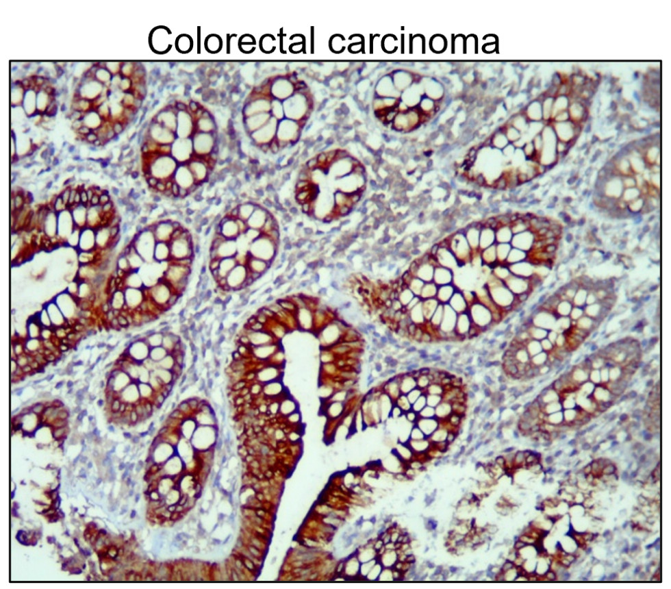 IR235-880 anti-Cytokeratin 14/17 antibody IHC image IR235-880 anti-Cytokeratin 14/17 antibody IHC image