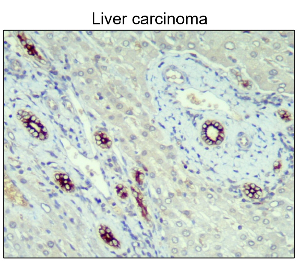 IR235-880 anti-Cytokeratin 14/17 antibody IHC image IR235-880 anti-Cytokeratin 14/17 antibody IHC image
