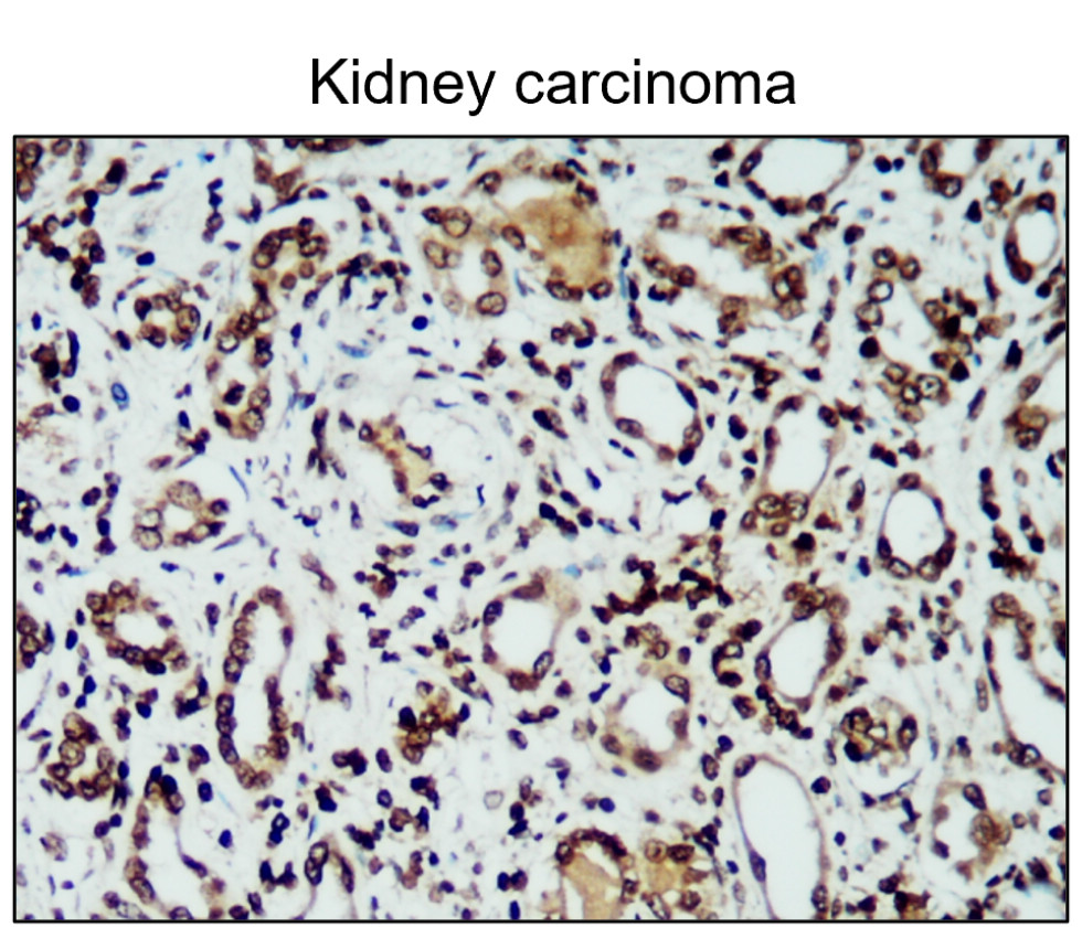 IR231-856 anti-iNOS antibody IHC image