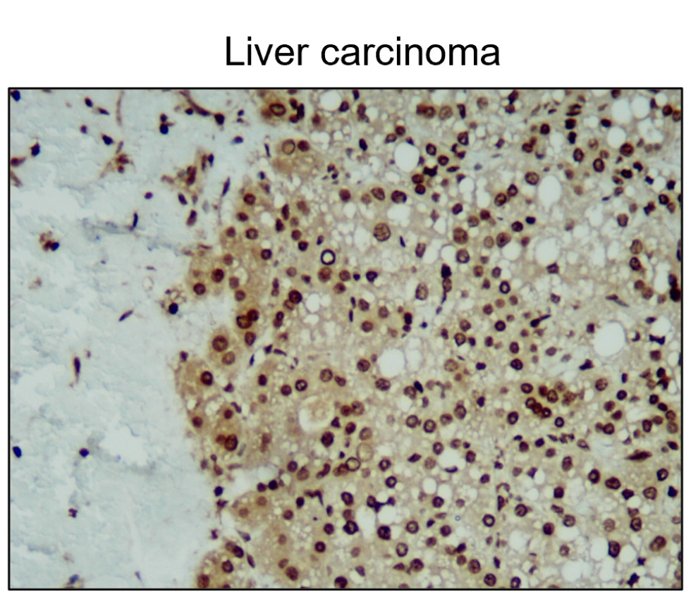 IR231-856 anti-iNOS antibody  IHC image