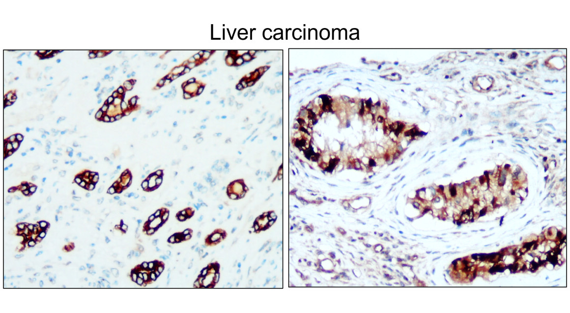 IR229-871 anti-Cytokeratin 8 antibody IHC image IR229-871 anti-Cytokeratin 8 antibody IHC image