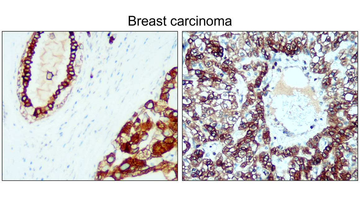 IR229-871 anti-Cytokeratin 8 antibody IHC image IR229-871 anti-Cytokeratin 8 antibody IHC image
