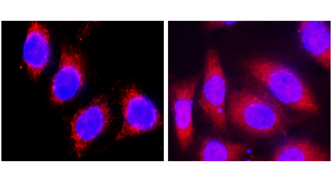 IR229-871 anti-Cytokeratin 8 antibody ICC/IF image IR229-871 anti-Cytokeratin 8 antibody ICC/IF image