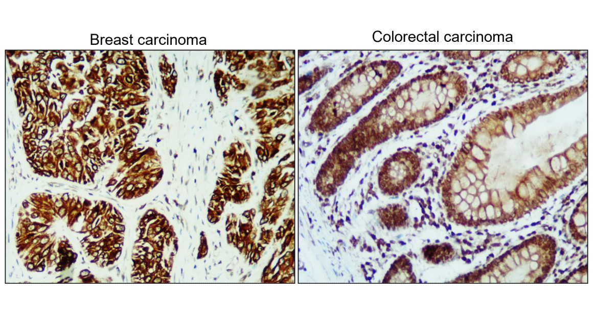 IR226-865 anti-Cytokeratin 5/6 antibody IHC image IR226-865 anti-Cytokeratin 5/6 antibody IHC image