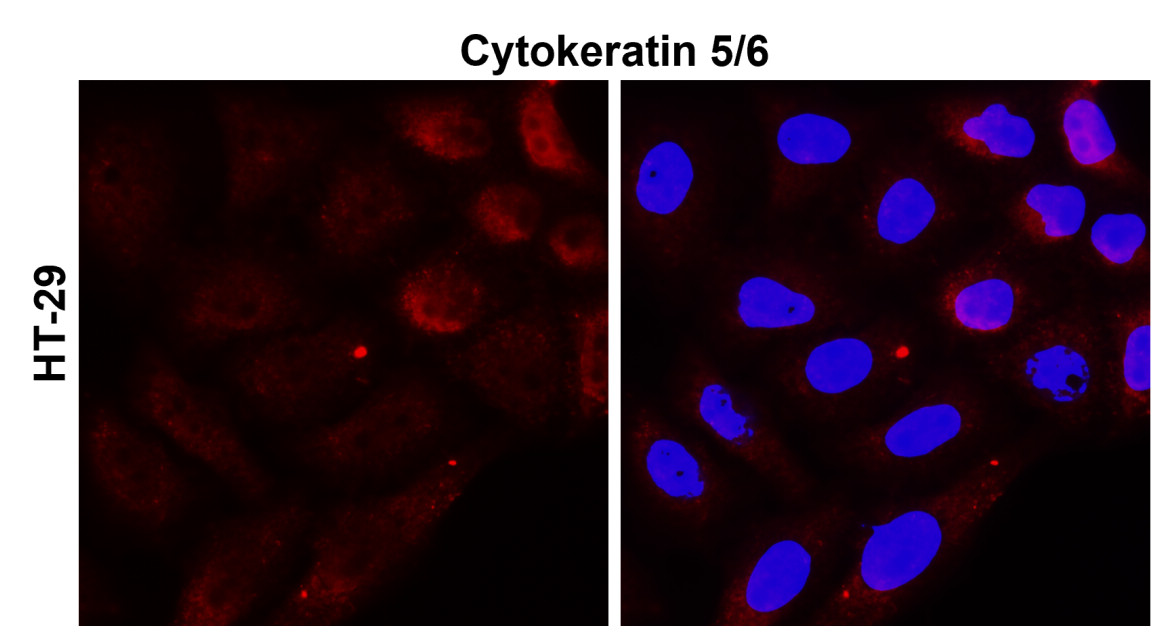 IR226-865 anti-Cytokeratin 5/6 antibody ICC/IF image IR226-865 anti-Cytokeratin 5/6 antibody ICC/IF image