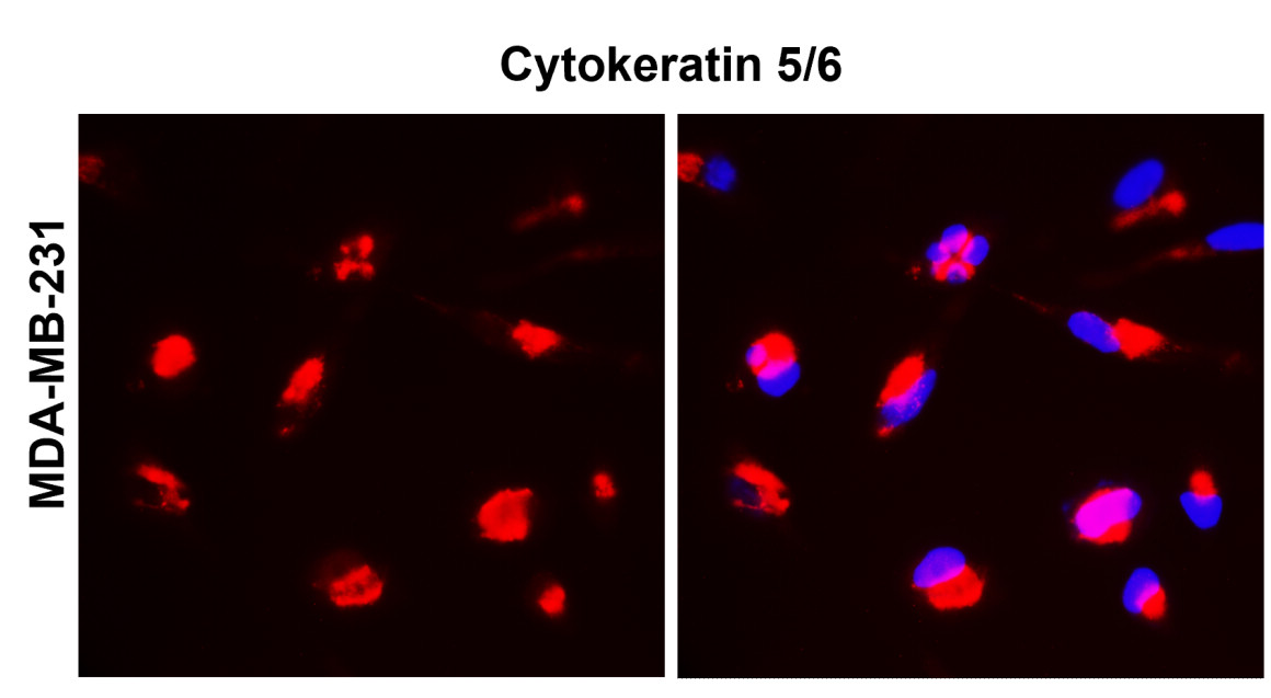 IR226-865 anti-Cytokeratin 5/6 antibody ICC/IF image IR226-865 anti-Cytokeratin 5/6 antibody ICC/IF image