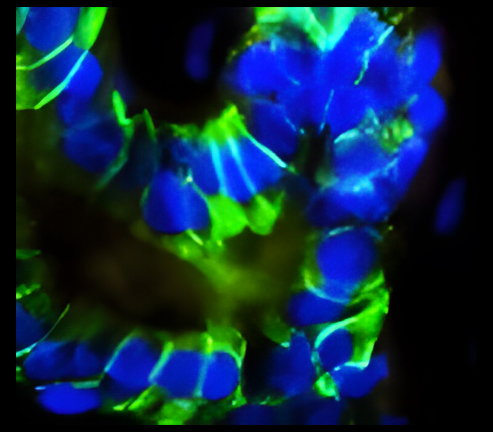 IR218-3-Bio anti-EpCAM Biotinylated antibody IF image IR218-3-Bio anti-EpCAM Biotinylated antibody IF image