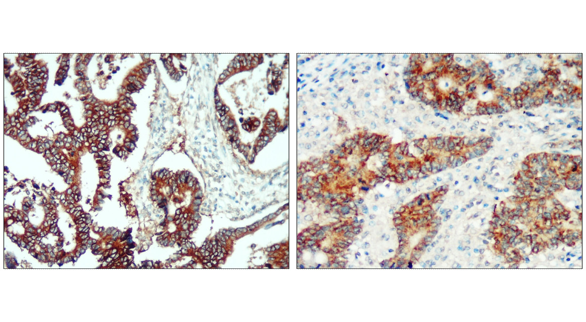 IR218-3 anti- EpCAM antibody IHC image