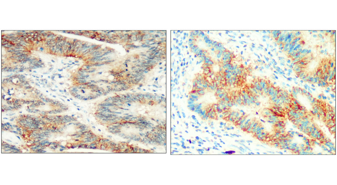 IR218-3 anti- EpCAM antibody IHC image