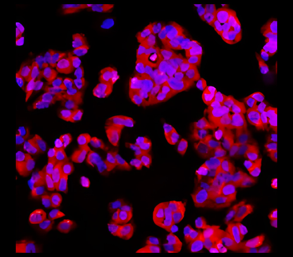 IR218-3 anti- EpCAM antibody ICC/IF image