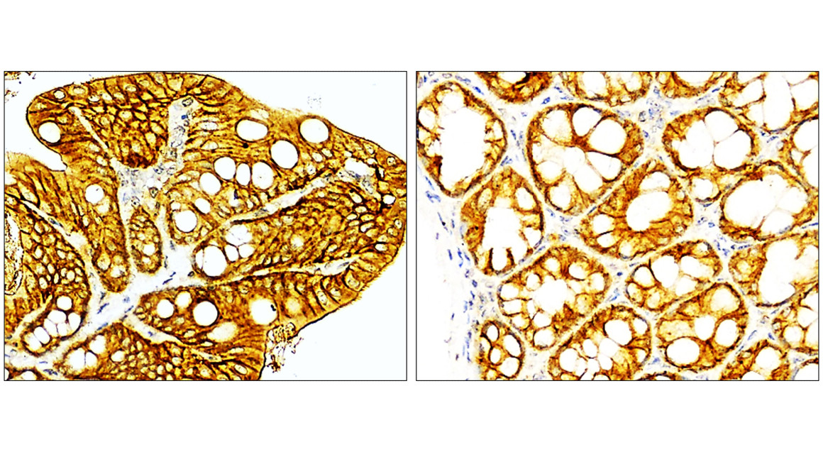 IR218-3 anti- EpCAM antibody IHC image