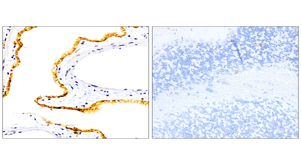 IR218-3 anti- EpCAM antibody IHC image