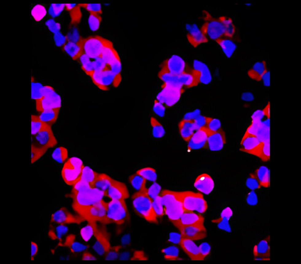 IR218-1-Bio anti-EpCAM Biotinylated antibody  IF image