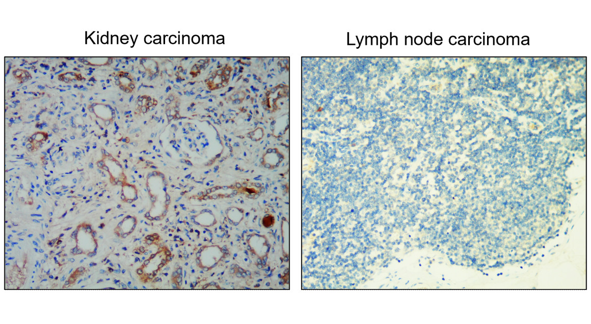 IR218-1 anti- EpCAM antibody IHC image IR218-1 anti- EpCAM antibody IHC image