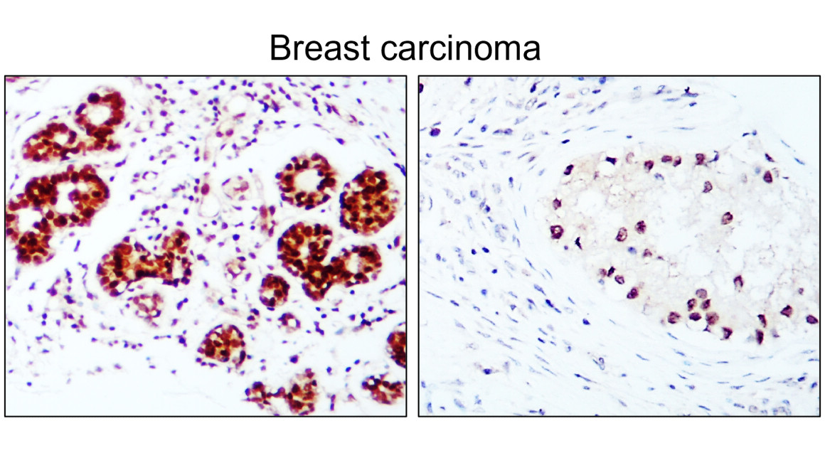 IR213-777 anti- Estrogen Receptor alpha antibody IHC image IR213-777 anti- Estrogen Receptor alpha antibody IHC image