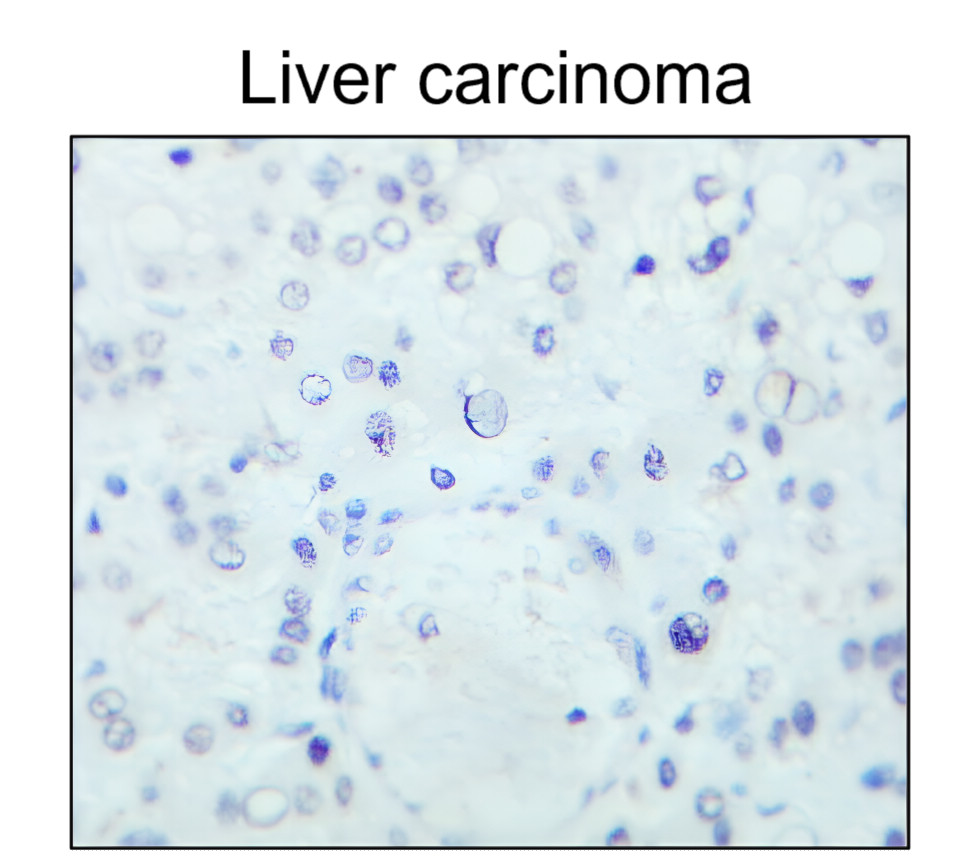 IR213-777 anti- Estrogen Receptor alpha antibody IHC image IR213-777 anti- Estrogen Receptor alpha antibody IHC image