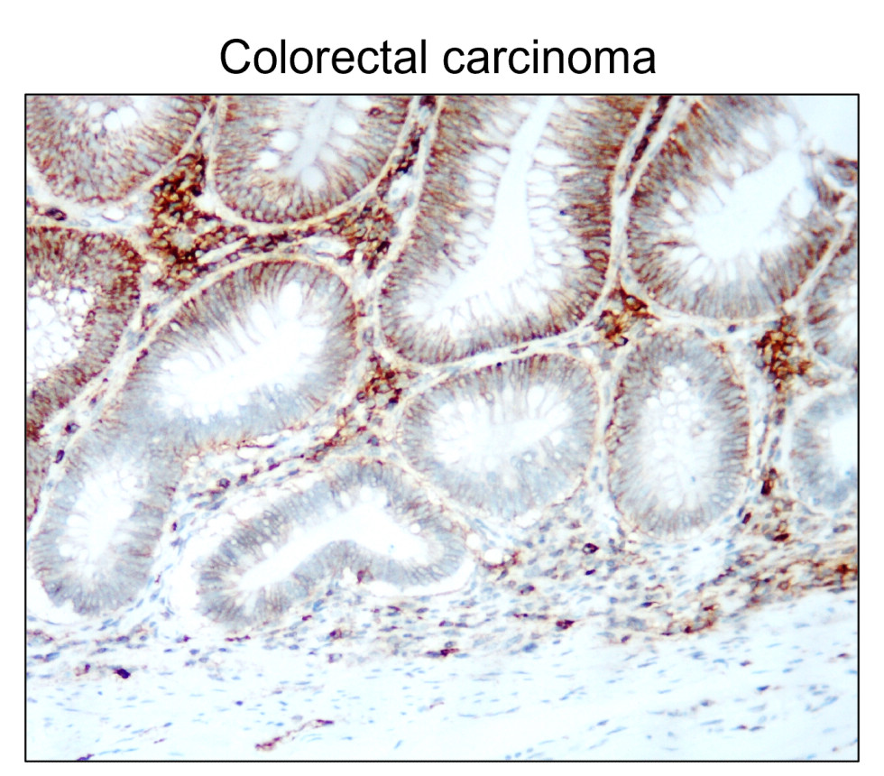 IR208-752 anti-CD44 antibody IHC image IR208-752 anti-CD44 antibody IHC image