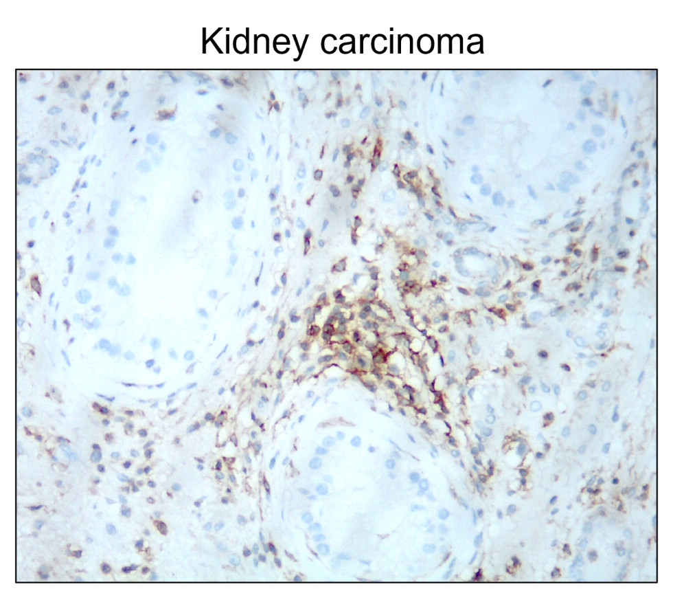 IR208-752 anti-CD44 antibody IHC image
