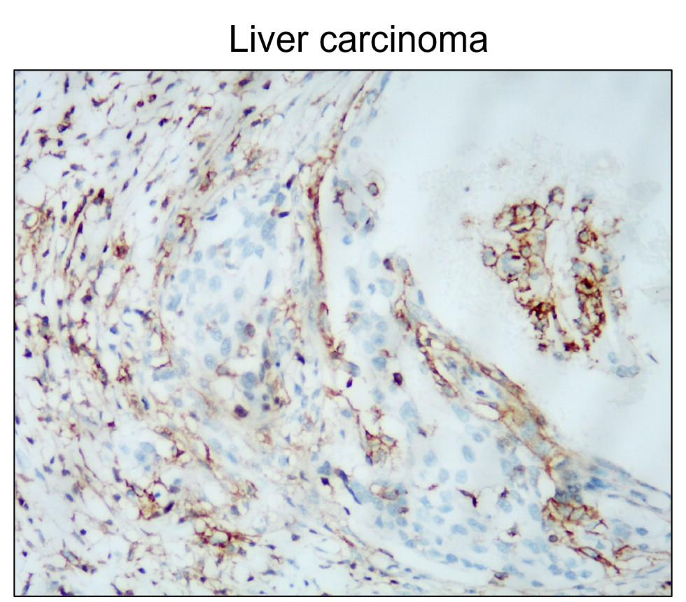 IR208-752 anti-CD44 antibody IHC image