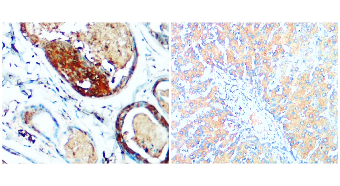 IR189-709 anti-p38 MAPK antibody IHC image IR189-709 anti-p38 MAPK antibody IHC image